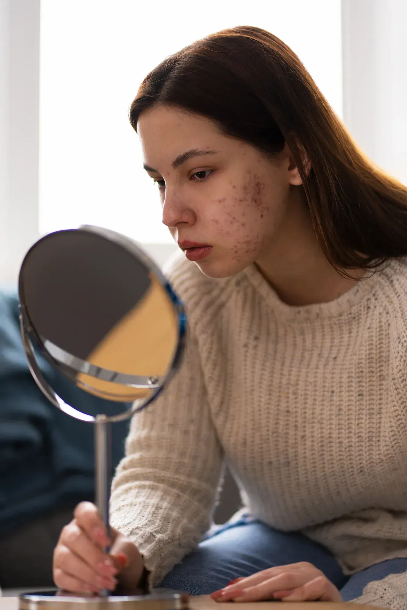 Close-up view of acne-prone facial skin at Radiant Laser MD Cambridge