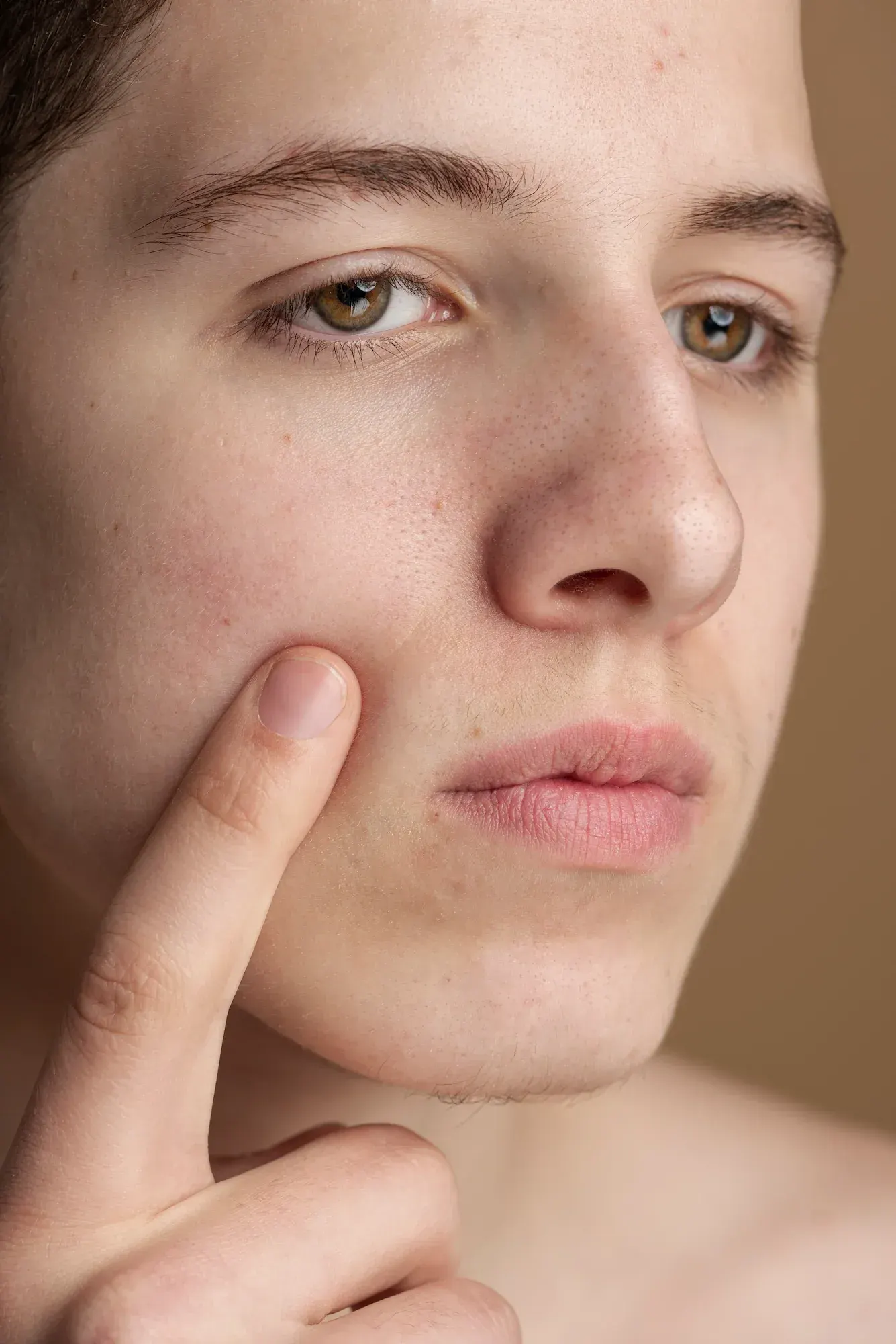 Close-up view of enlarged facial pores on the nose and cheeks at Radiant Laser MD Cambridge