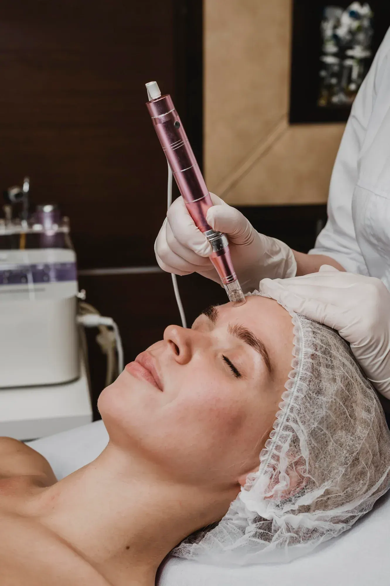 Safety and clinical information for microneedling at Radiant Laser MD Cambridge
